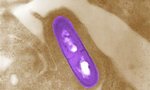 Listeria bacteria in a microscopic image courtesy of the Centers for Disease Control and Prevention. REUTERS/Handout