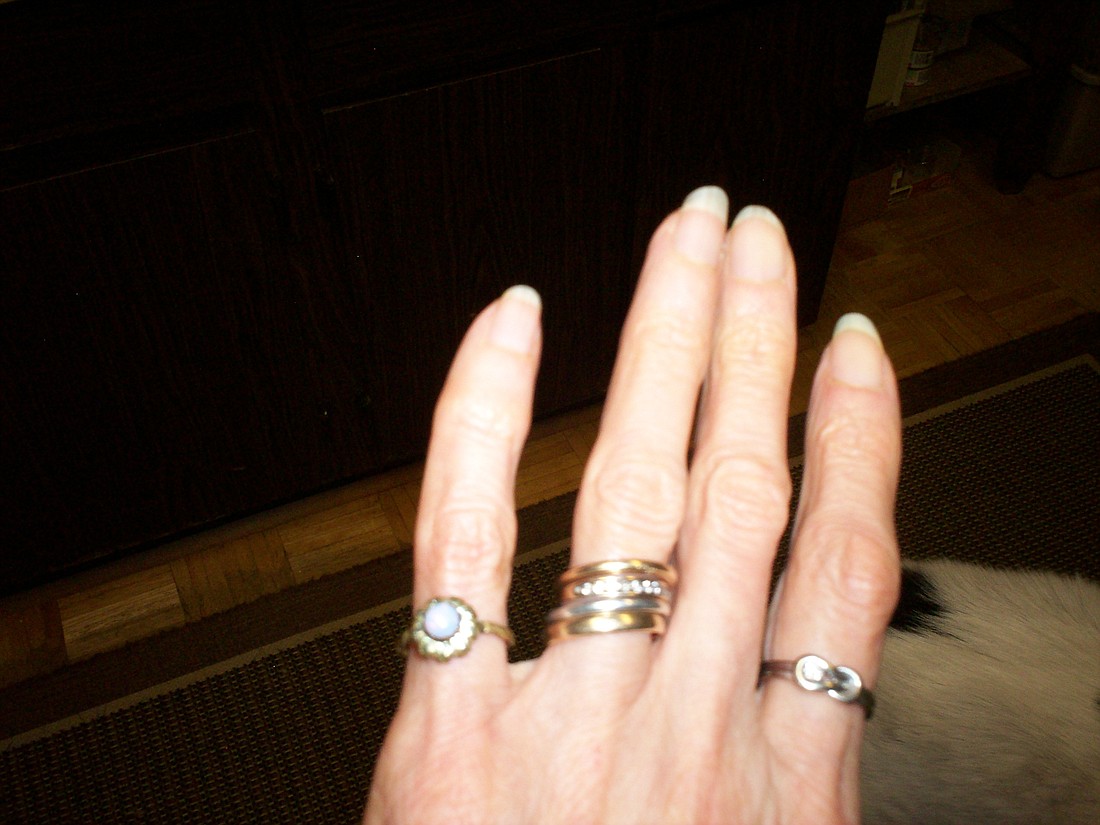 Rings from three husbands. Twice widowed.