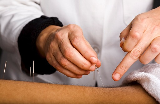 There are several options for home treatment of chronic back pain; acupuncture being one of them. 